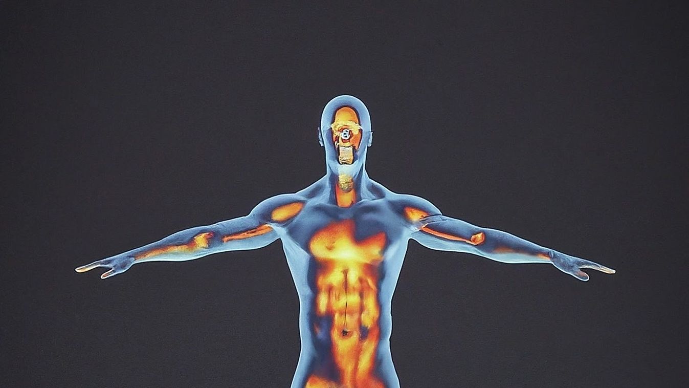 3d,Representation,Of,Human,Body,,Visible,Heat,Map,Showing,Rising