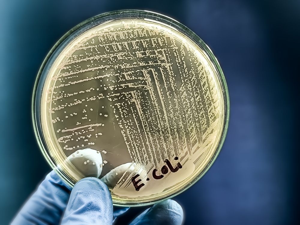 A,Microbiological,Culture,Petri,Dish,With,A,Colonies,Of,The